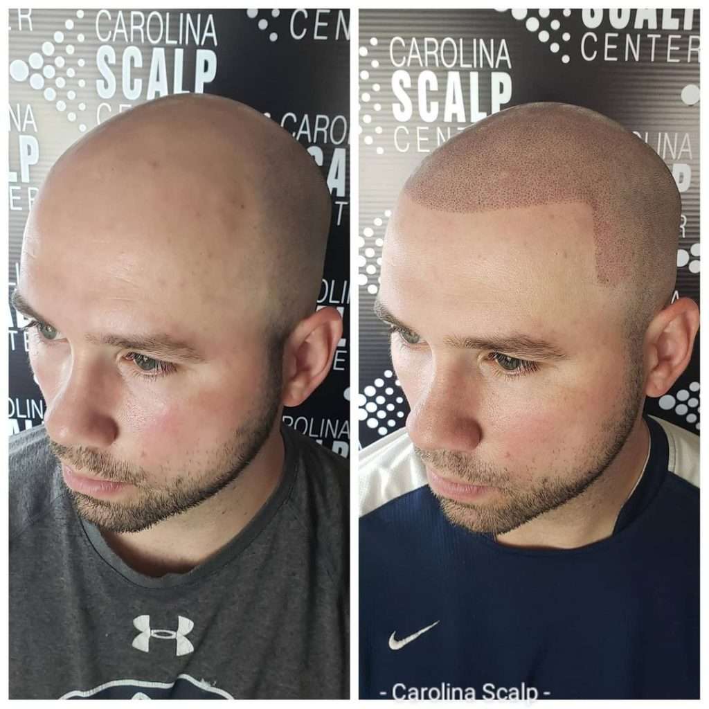 1: carolina scalp center
