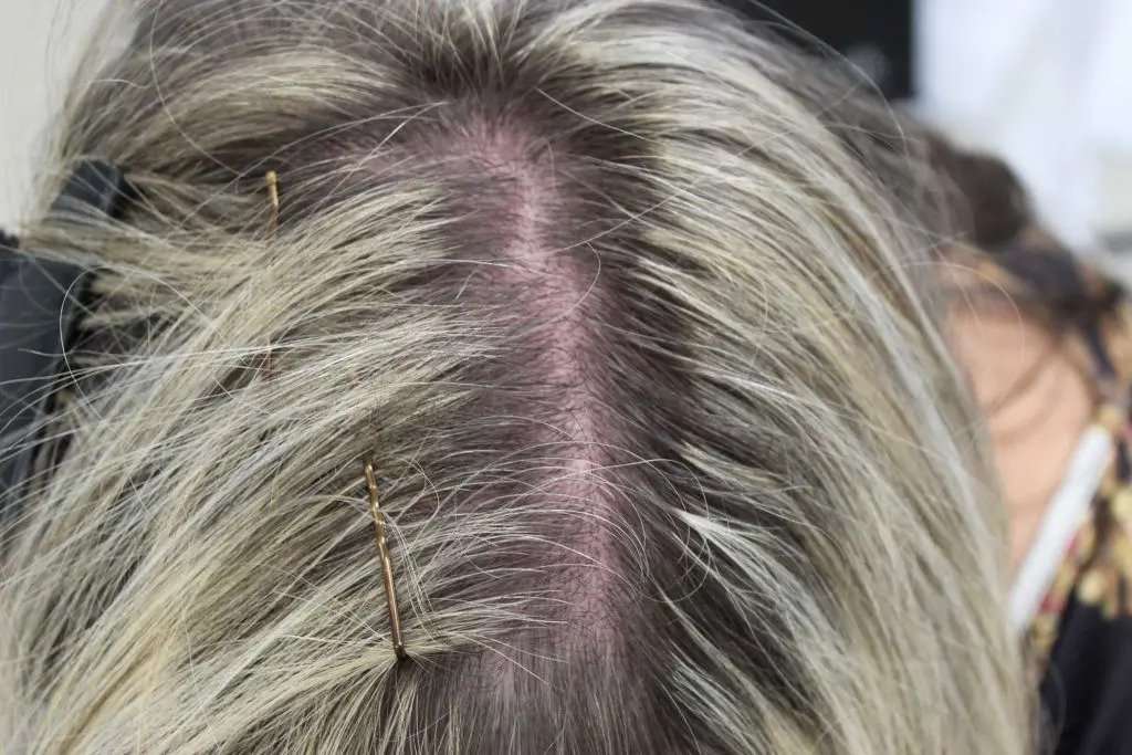 11: carolina scalp center