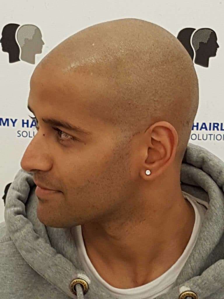 14: carolina scalp center