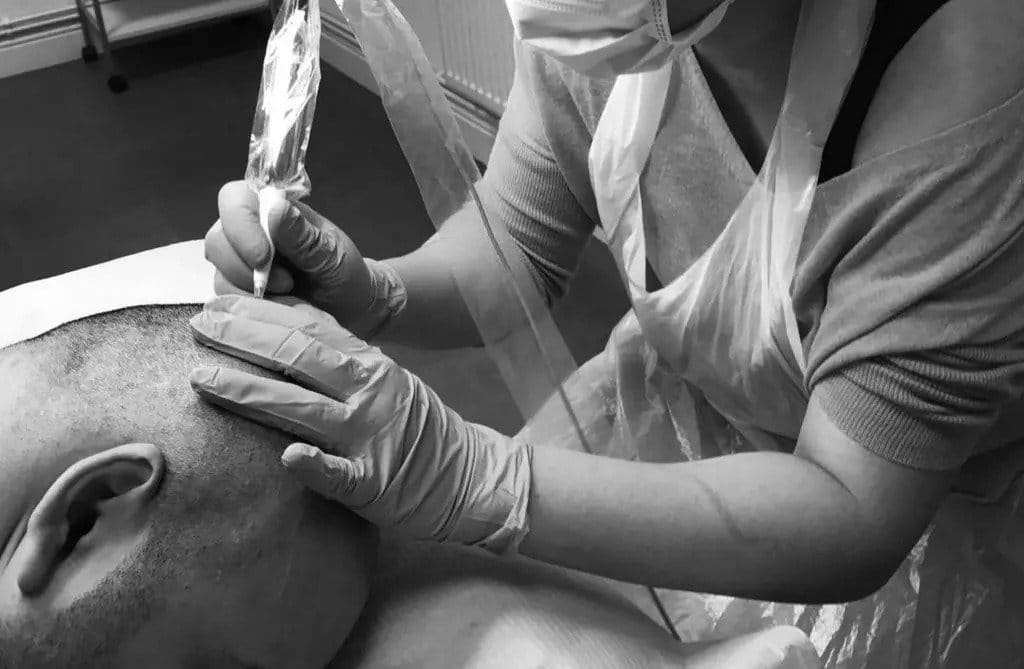 15: carolina scalp center