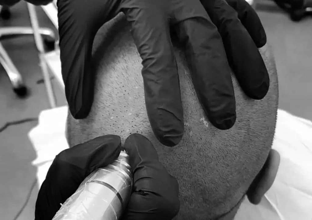 17: carolina scalp center