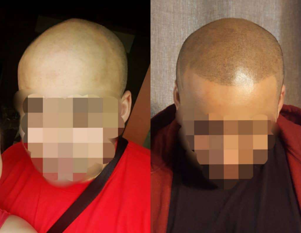 2: carolina scalp center