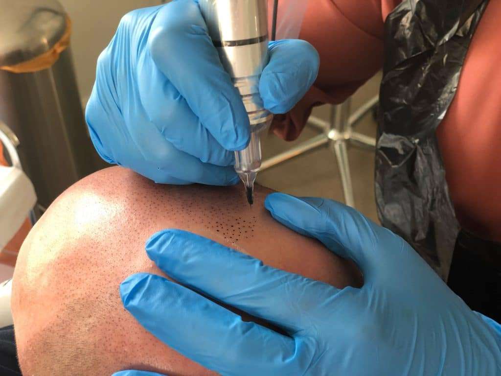 4: carolina scalp center