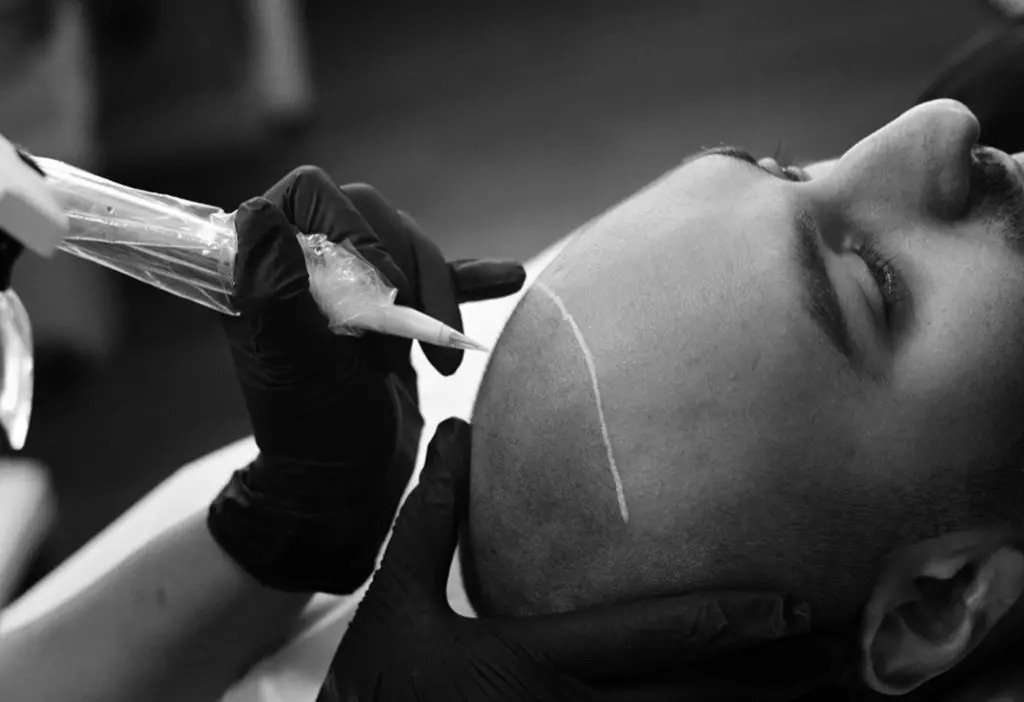 5: carolina scalp center