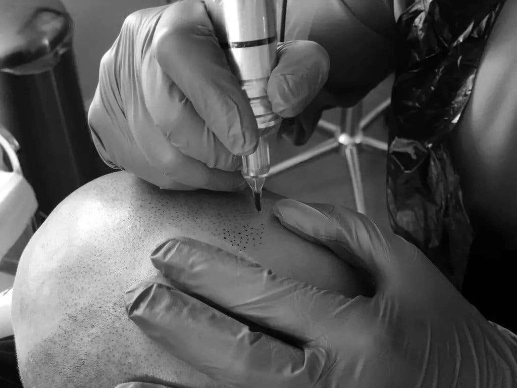 9: carolina scalp center