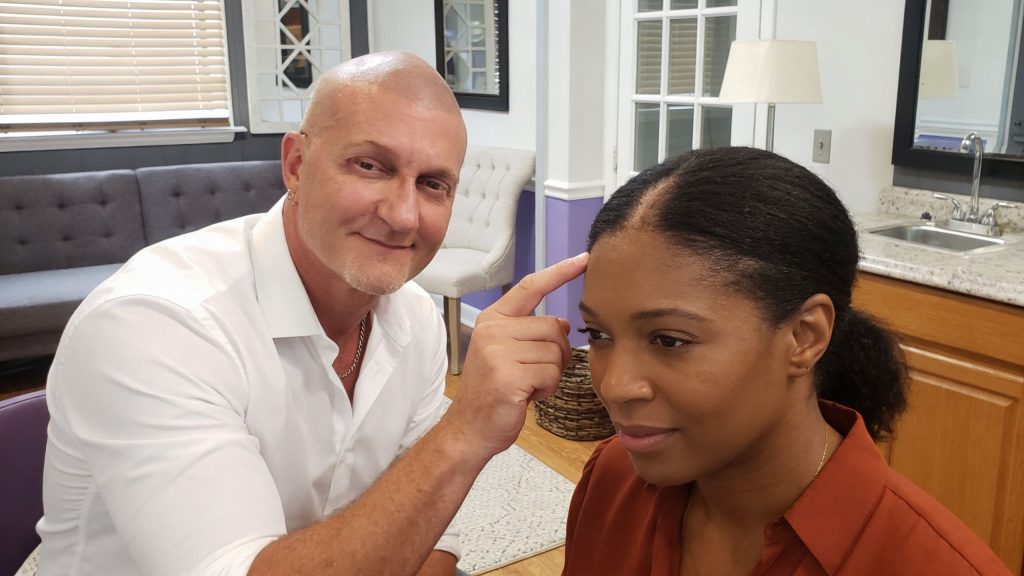 Traction alopecia smp women